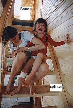 Удаление заноз.jpg